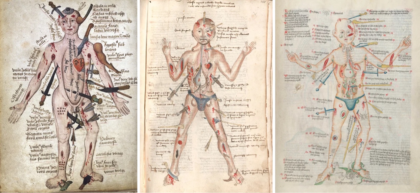 Medieval Wound Man