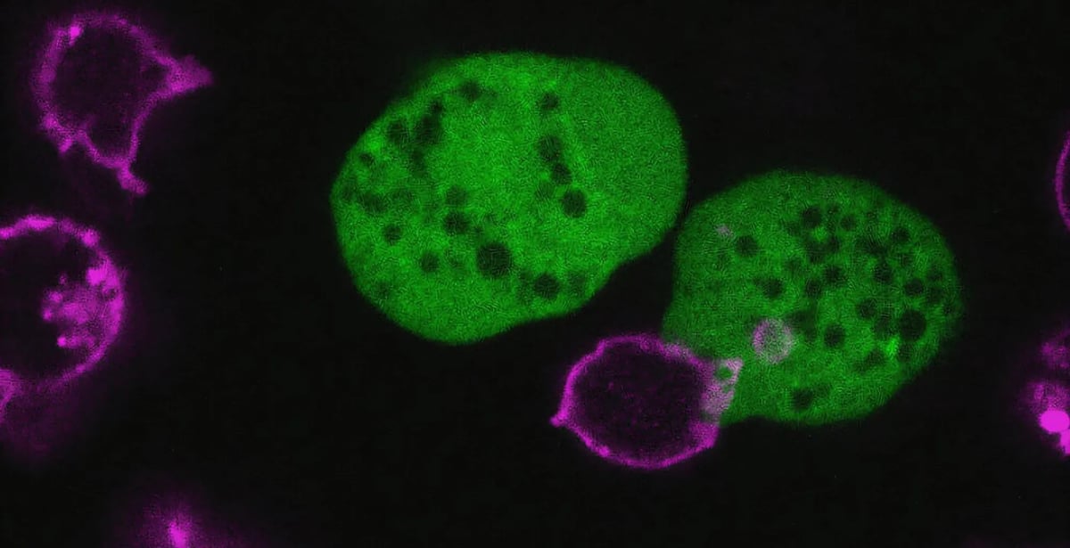 Entamoeba-histolytica.jpg