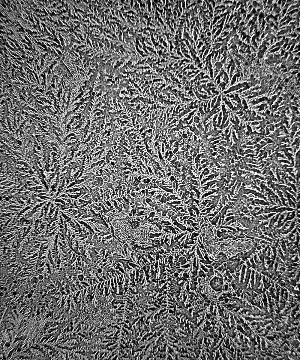 microscopic image of dried tears