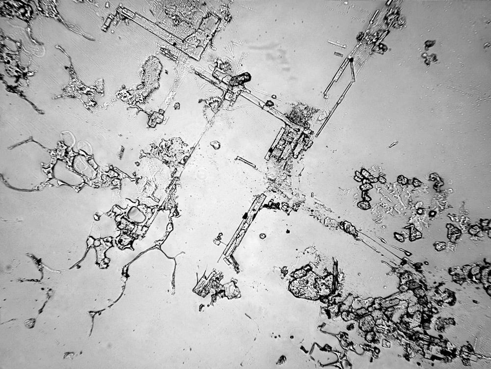 microscopic image of dried tears