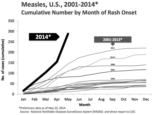 2014 measles rise