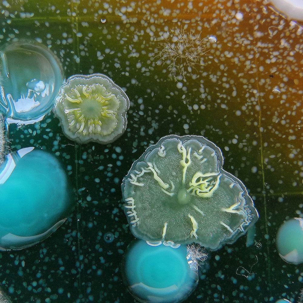 colorful mold in a petri dish