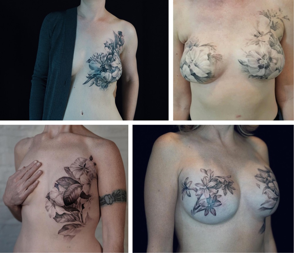 Postmastectomy Tattooing Helps Women with Breast Cancer Heal