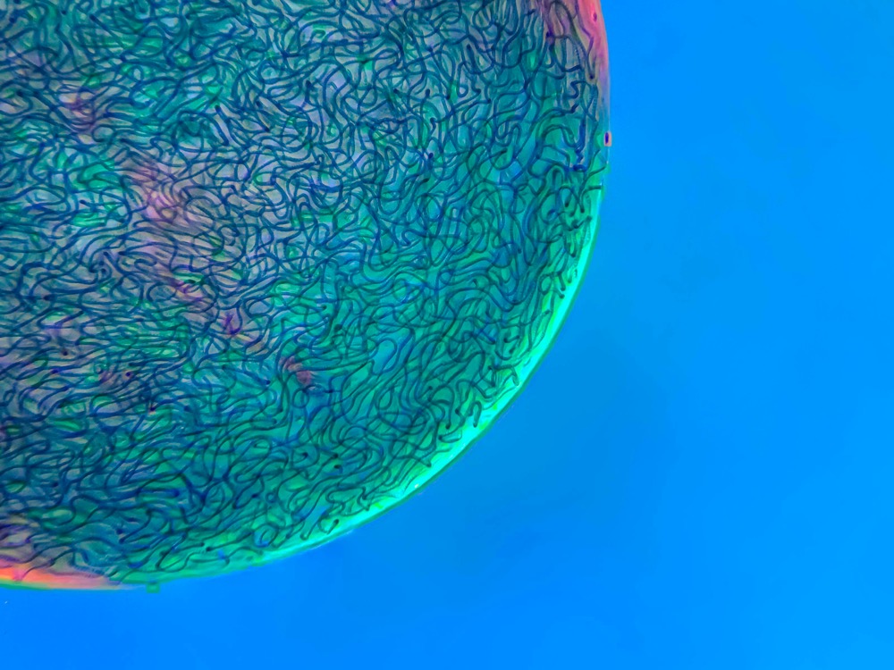 Filamentous strands of Nostoc cyanobacteria captured inside a gelatinous matrix
